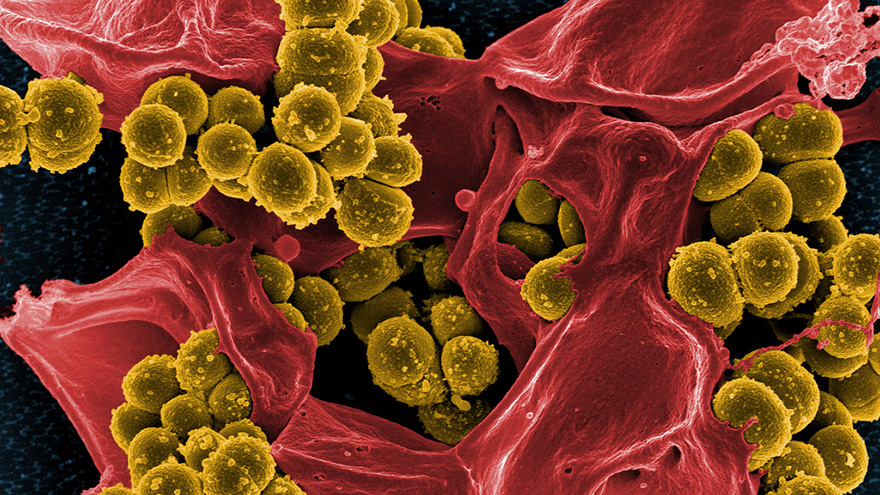Methicillin-Resistant Staphylococcus aureus 