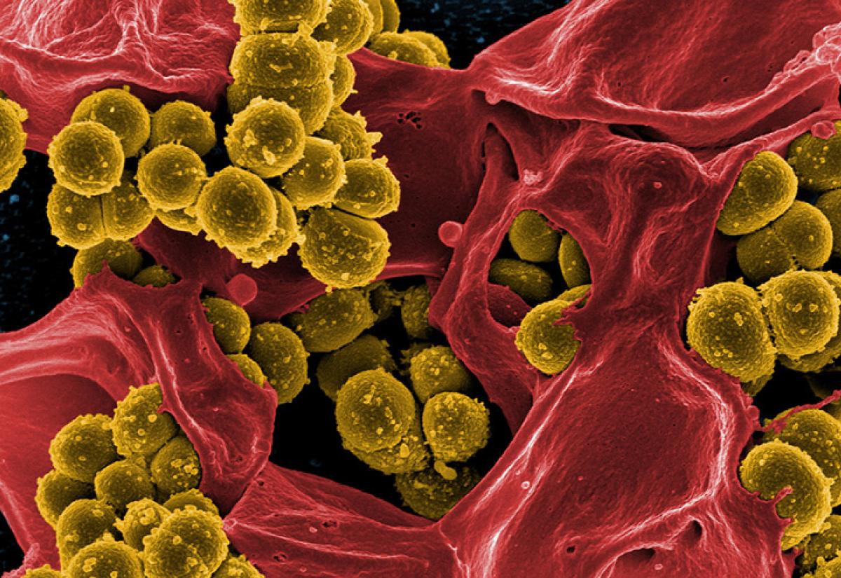 Methicillin-Resistant Staphylococcus aureus 
